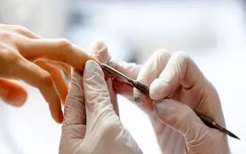 قارچ در ناخن کاشت شده را جدی بگیرید