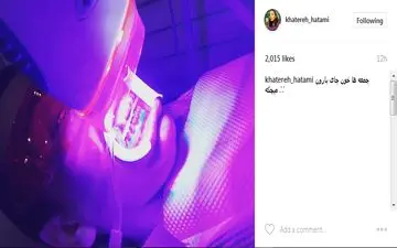 عکس|عکس عجیب خانم بازیگر در دندانپزشکی!