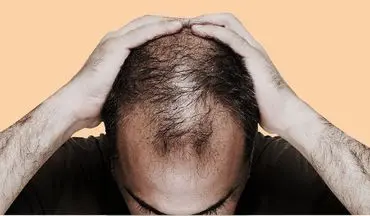 چگونه استرس فولیکول‌های مو را به یک هدف ایمنی تبدیل می‌کند؟