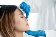 جراحی بینی ترمیمی چیست و چه زمانی به آن نیاز دارید؟