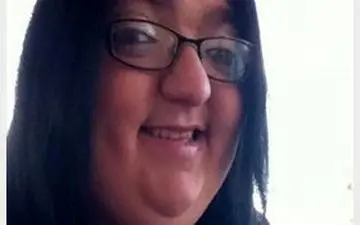 درخواست غرامت یک دختر بابت زشتی چهره 