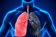 چگونه از خطرات  بیماری ریوی در امان بمانیم؟
