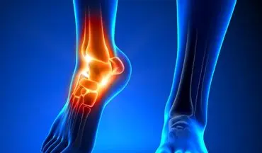 علل شایع درد قسمت داخلی پا