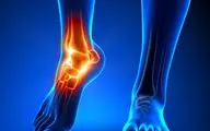 علل شایع درد قسمت داخلی پا