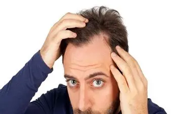 راه‌حل یک هکر زیستی مشهور برای توقف ریزش موی ارثی
