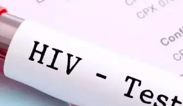 آیا HIV و ایدز یکی هستند؟ |  HIV به طور طبیعی قابل درمان است؟


