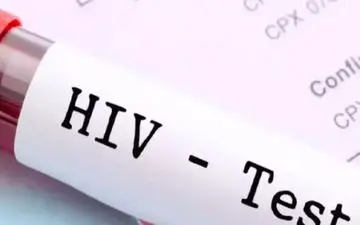 آیا HIV و ایدز یکی هستند؟ |  HIV به طور طبیعی قابل درمان است؟



