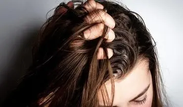 روش های خانگی برای کاهش چربی موی سر
