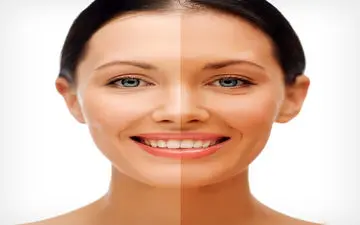 چه مواد غذایی را بخوریم تا پوستمان روشن و زیبا شود؟
