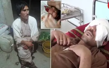عشق پسر22 ساله کار دستش داد/ پدر با «قاشق» چشمان پسرش را از حدقه در آورد + عکس 14+ 