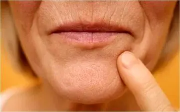 چرا لب‌ها با بالا رفتن سن نازک می‌شوند؟