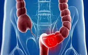 عادات و عواملی که سلامت روده را نشانه می‌روند