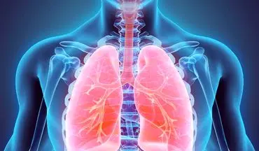 درباره نارسایی تنفسی حاد بیشتر بدانید