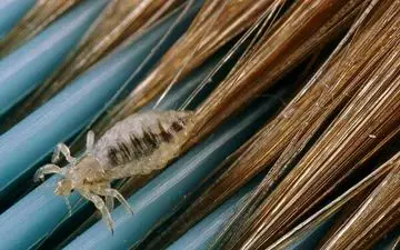 همه آنچه که باید درباره شپش بدانید