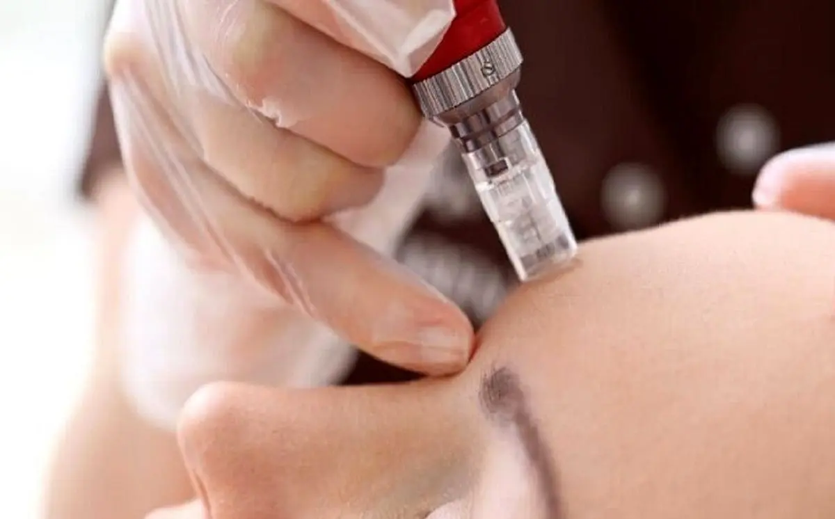 بادبادک فروشی که جراح زیبایی انجام می داد