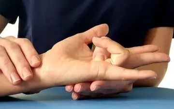 از انگشت ماشه‌ای چه می دانید؟

