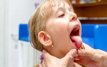 ورم لوزه به چه علت است؟