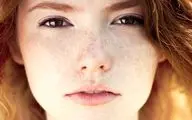 ترفندهای زیبایی برای کاهش کک و مک پوست صورت| پانزده راهکار ساده و موثر 