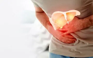 آیا درمانی برای کبد چرب وجود دارد؟