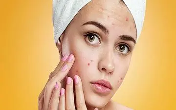 لک پوستی دارید؟ این اقدامات را انجام دهید و این مکمل ها را بخورید