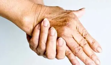 برجستگی رگ‌های پشت دستت رو این طوری درمان کن!