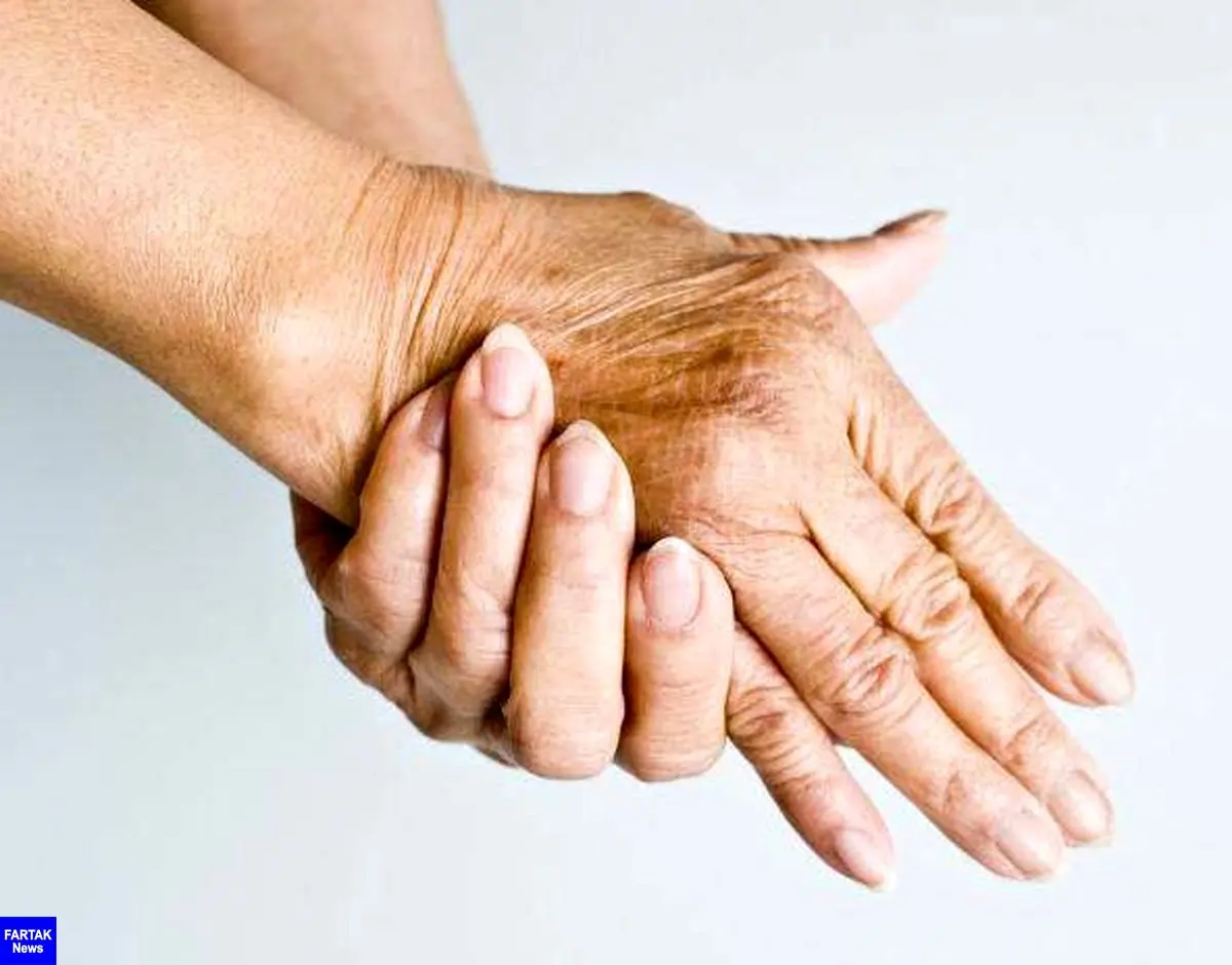  درمان ساده برجستگی رگ های پشت دست