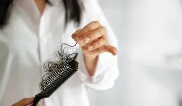 دلایل پنهان ریزش مو در زنان چیست؟ 