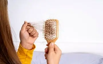 با این ۳ خوراکی از کچلی در امان باشید