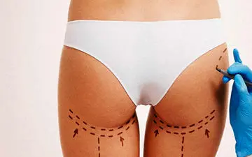 عمل پروتز باسن مناسب چه افرادی است؟