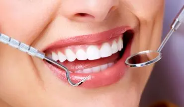 روش آسان از بین بردن جرم دندان