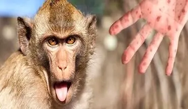 
جهش غیر عادی و سریع ویروس آبله میمونی 