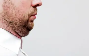 راهکارهایی برای رهایی از شر غبغب
