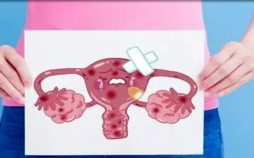 زنان این بیماری را جدی بگیرند