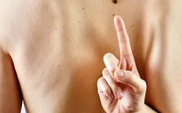 میدونی کجا بودن خال در بدنت شخصیت و راز پنهانت رو برملا میکنه؟!