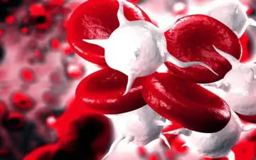 سپسیس و سایر عفونت‌های خون