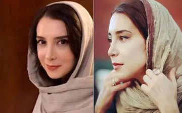 خانم بازیگر از راز فلج شدن فکش پرده برداری کرد!