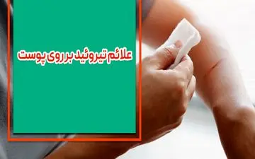 علائم تیروئید بر روی پوست چیست؟