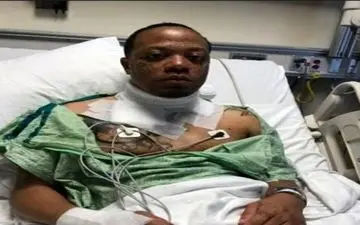 عکس/«شارژر آیفون» پوست مرد را کند!