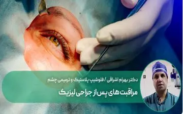 پس از جراحی لیزیک چه کار کنیم؟ | مراقبت های پس از جراحی لیزیک

