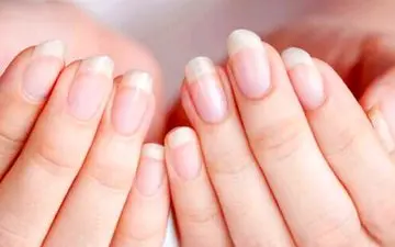 با این راهکارها ناخن‌های سالم داشته باشید
