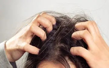 خارش پوست سر دارید؟ پای کمبود این ویتامین‌ها در میان است