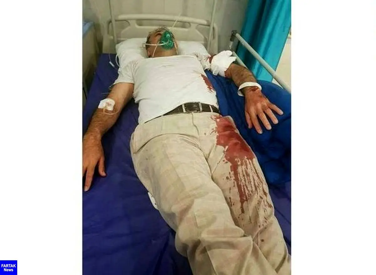 حمله خونین با قمه به رئیس شورای شهر بومهن + عکس