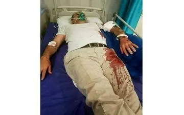 حمله خونین با قمه به رئیس شورای شهر بومهن + عکس