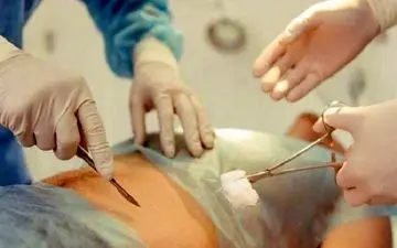 چگونگی تشخیص عفونت آپاندیس