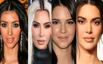 جراحی‌هایی که نجات‌بخش شدند/ از کریس تا کایلی؛ قبل و بعد از جراحی‌های خانواده‌ی پرحاشیه هالیوود