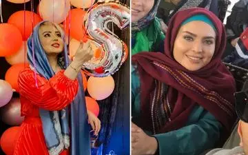 تولد "سولماز آقمقانی" با چهره‌ای پف کرده و پر از پروتز+عکس