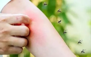 چطور از نیش پشه‌ امان بمانیم؟ | درمان‌ نیش پشه

