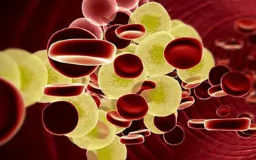 چربی خون بالا