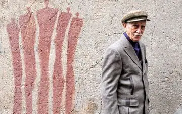 بازیگر ایرانی در بستر بیماری