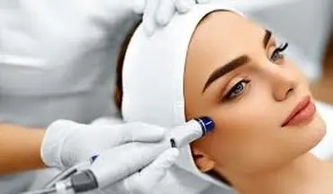 عوارض لیزر در صورت مراجعه به افراد غیرمتخصص